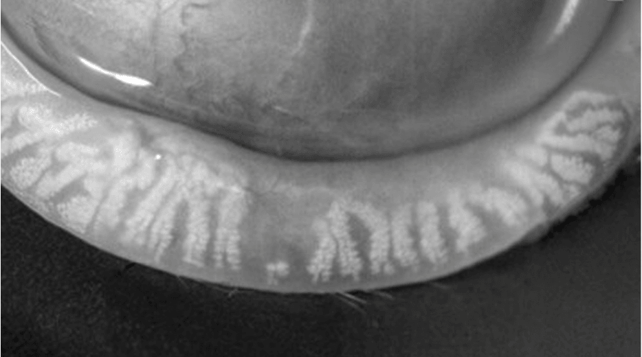 Meibomian gland oil layer secretion