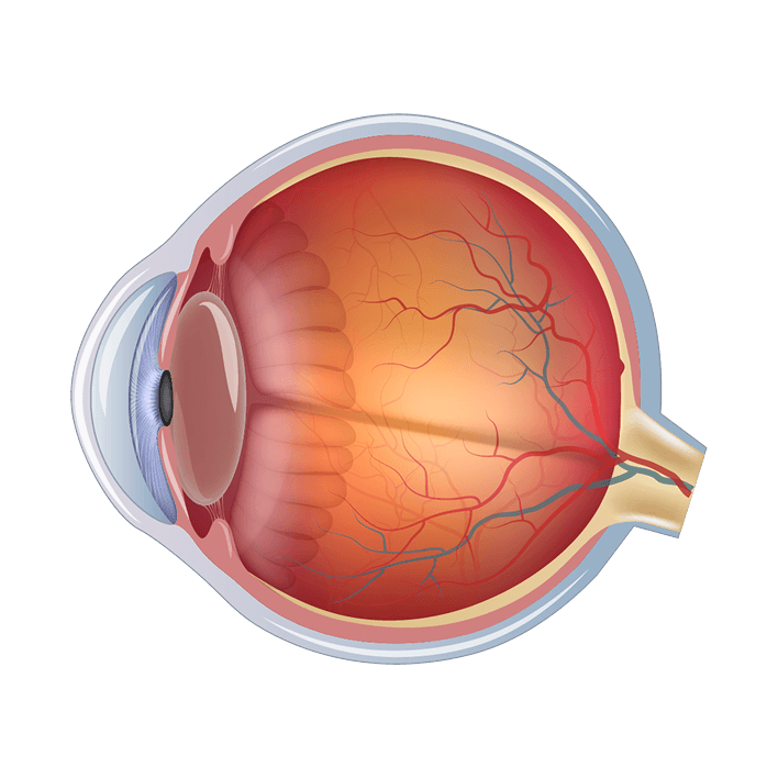 포도막염 발병 위치별 분류