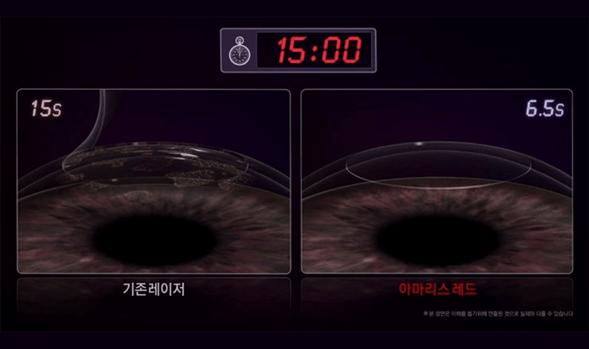 Ultra-fast 1050Hz, overwhelming irradiation speed