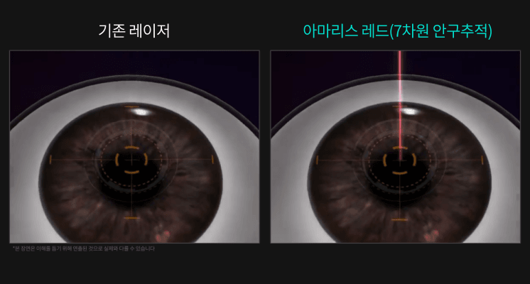 7D Eye Tracking system