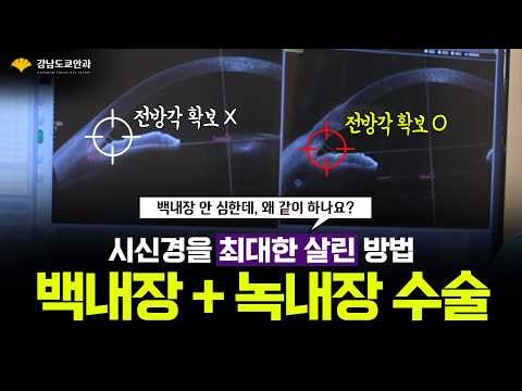 시신경을 최대한 살리기 위해 선택한 백내장+녹내장 수술