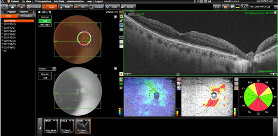 김OO 수술 후 검사