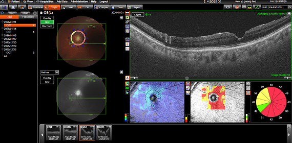 유OO 수술 후 검사