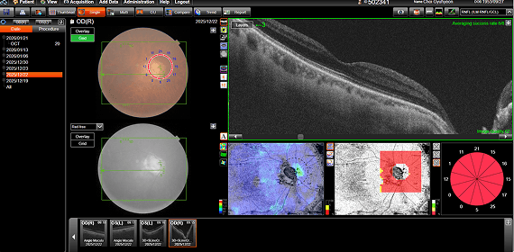 최OO 수술 전 검사