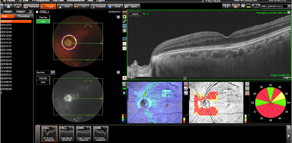 허OO 수술 후 검사
