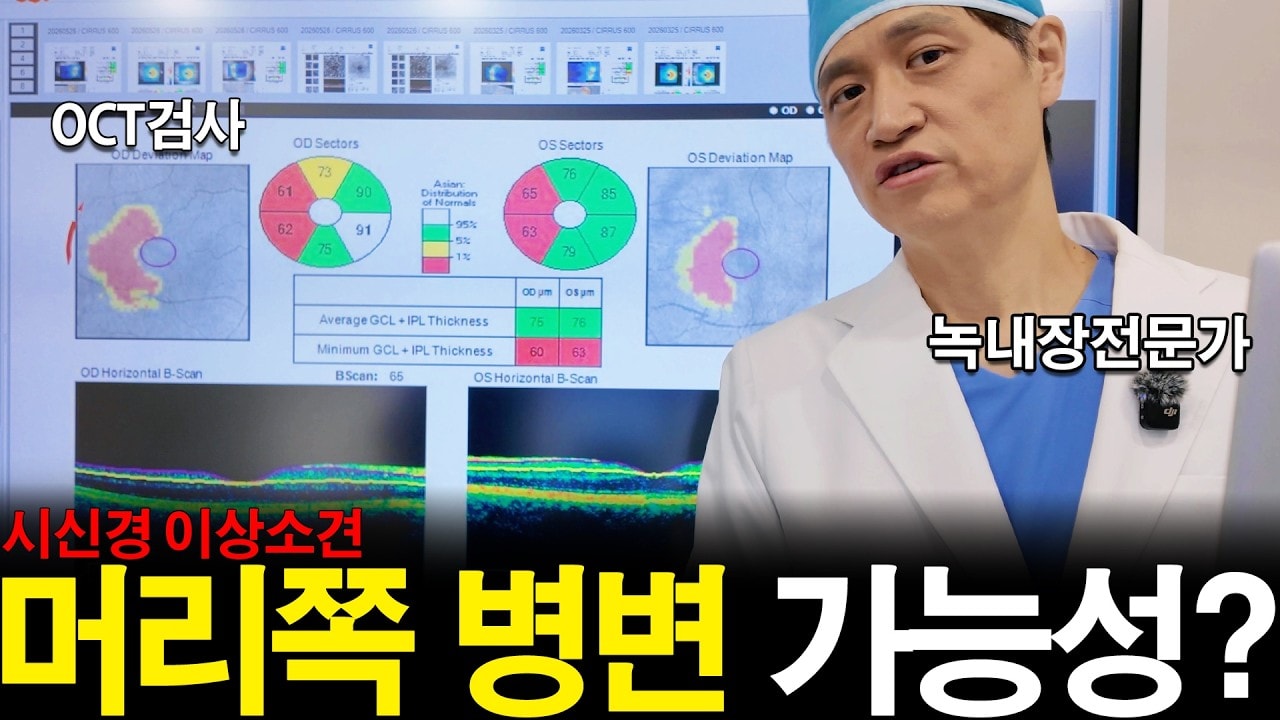 시야가 흐린데 녹내장일까? 뇌혈관질환까지 감별이 필요한 이유