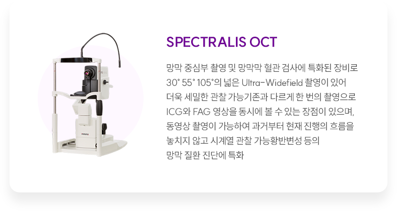 시신경 검사 사진