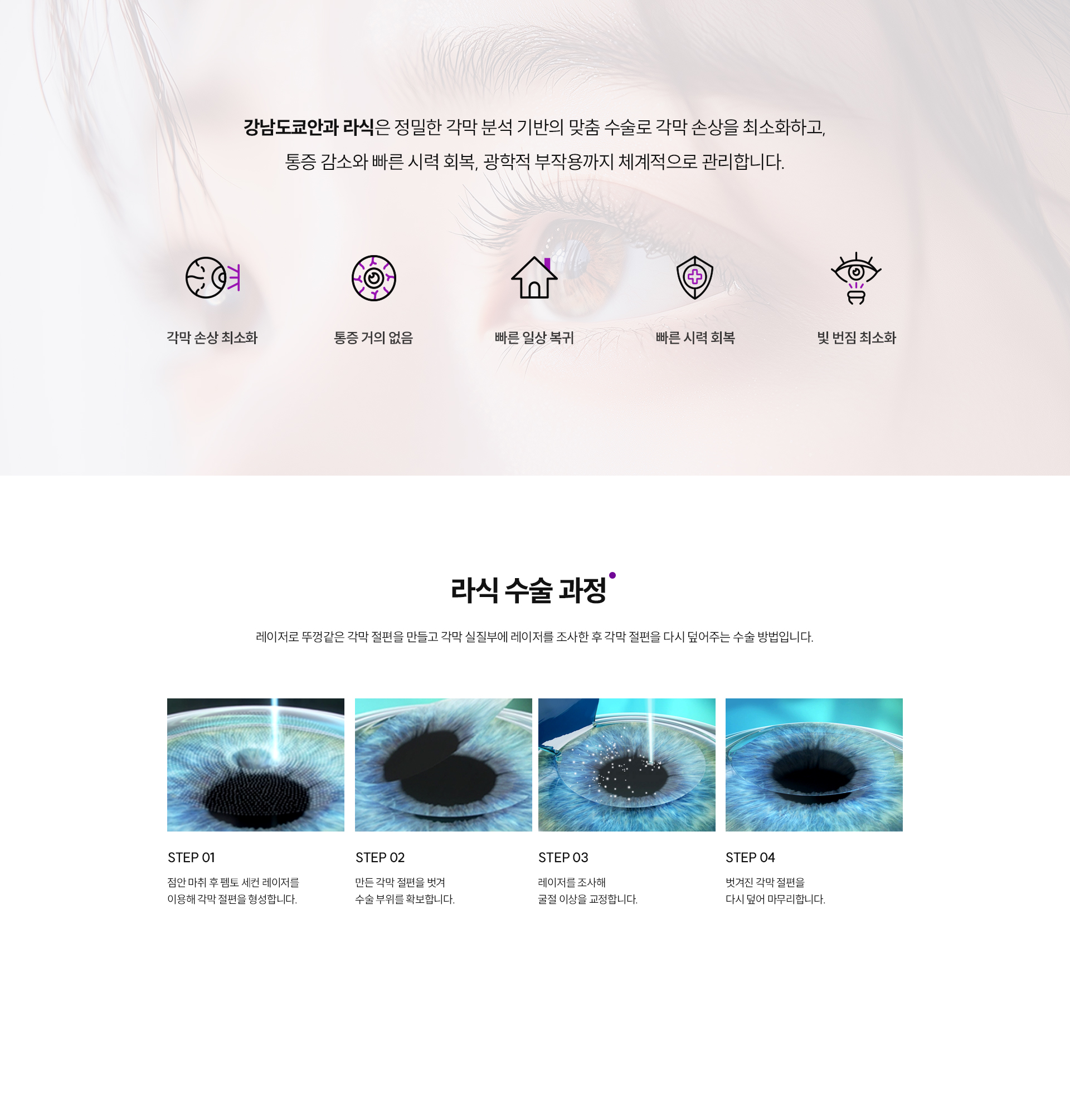 라섹수술이미지