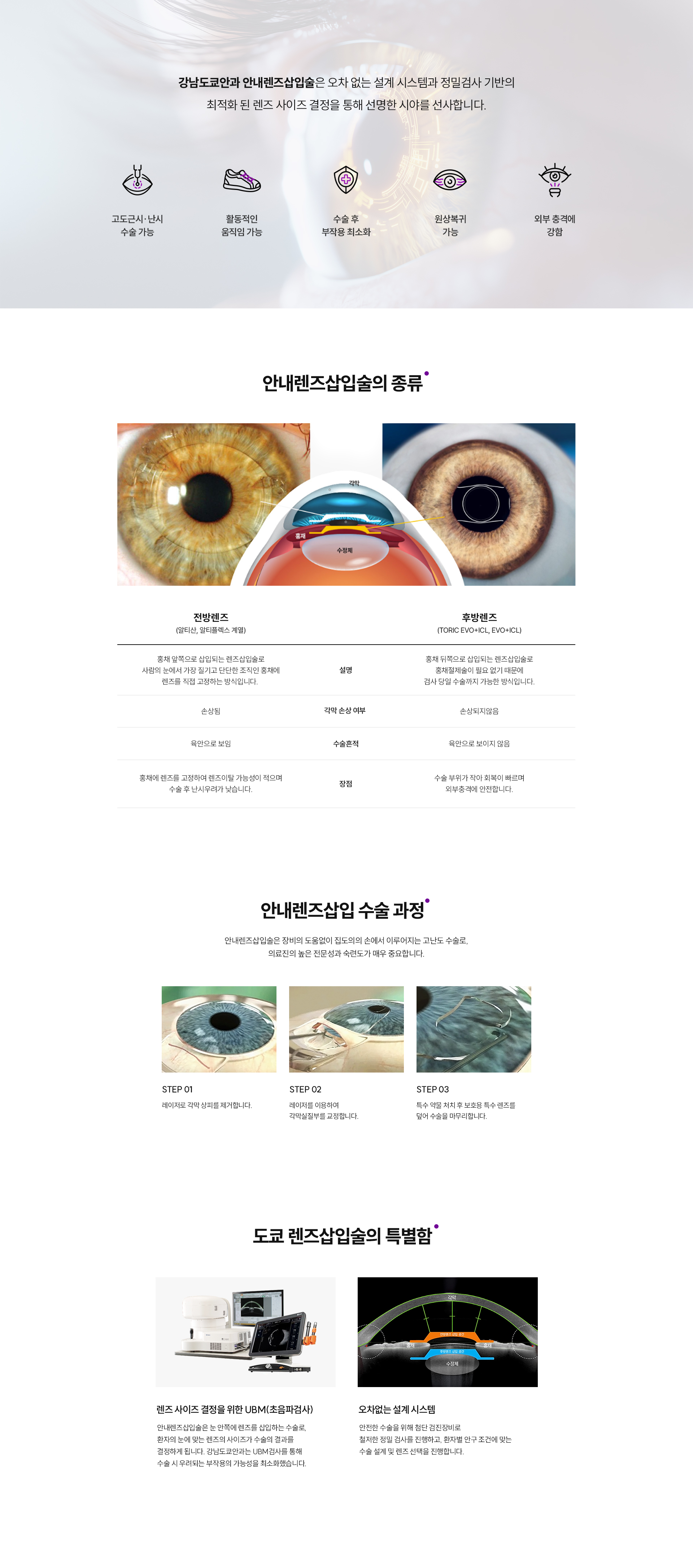 라섹수술이미지