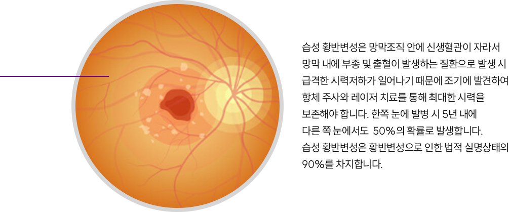 망막 이미지